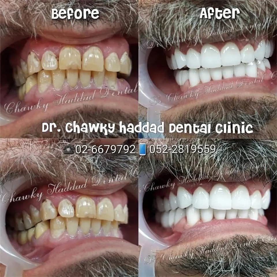 DR. Chawky Haddad Dental Clinic photo 3