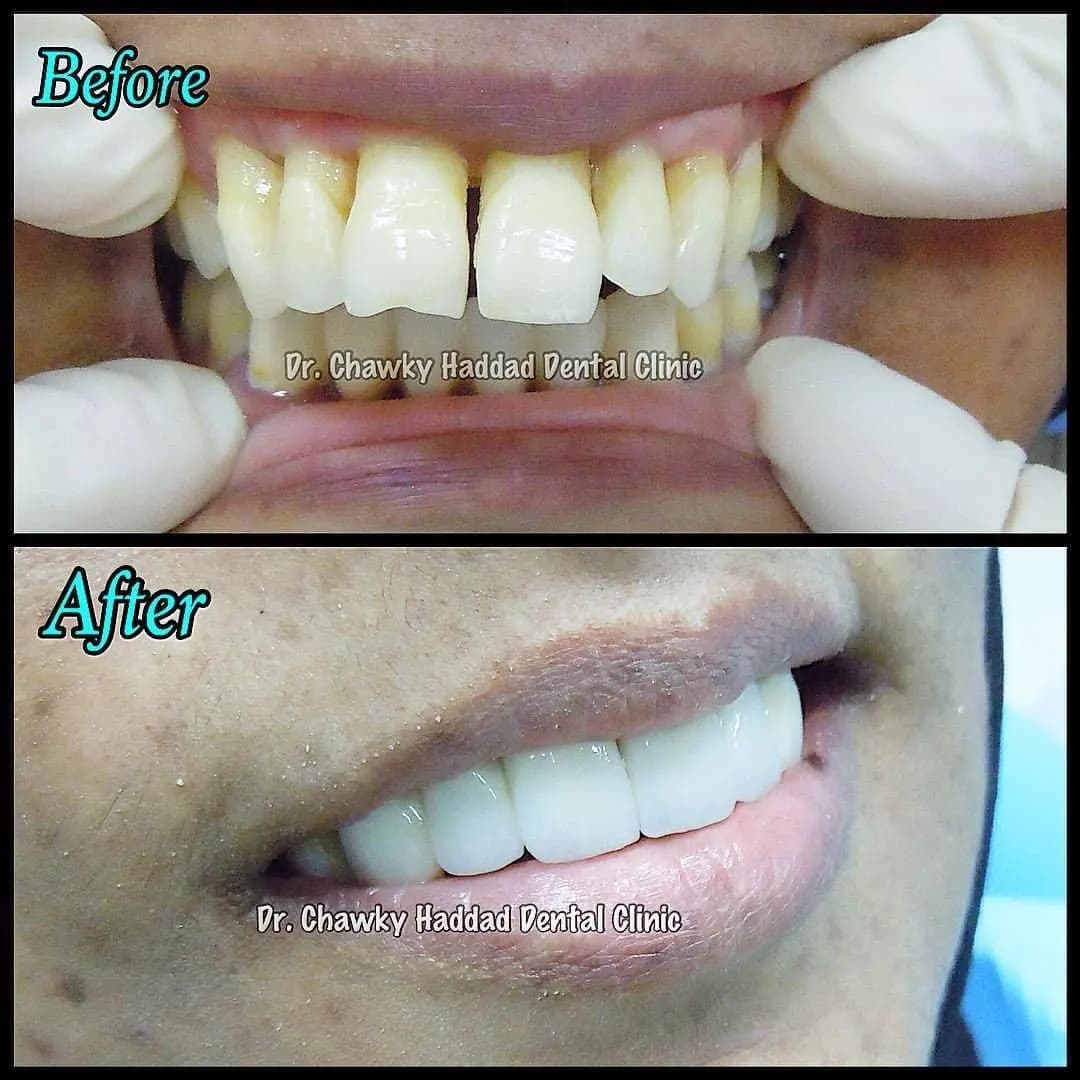 DR. Chawky Haddad Dental Clinic photo 5