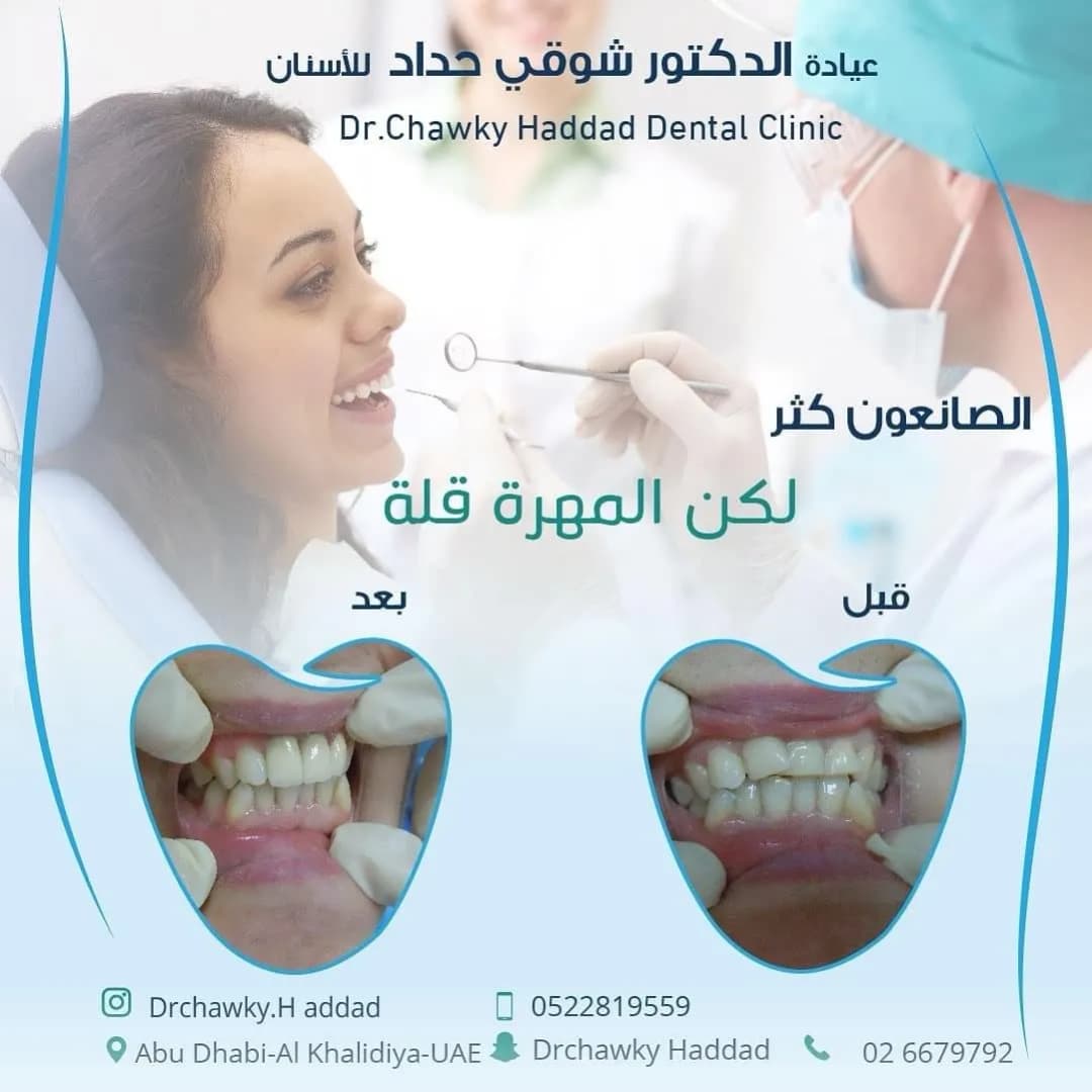 DR. Chawky Haddad Dental Clinic — صورة 6