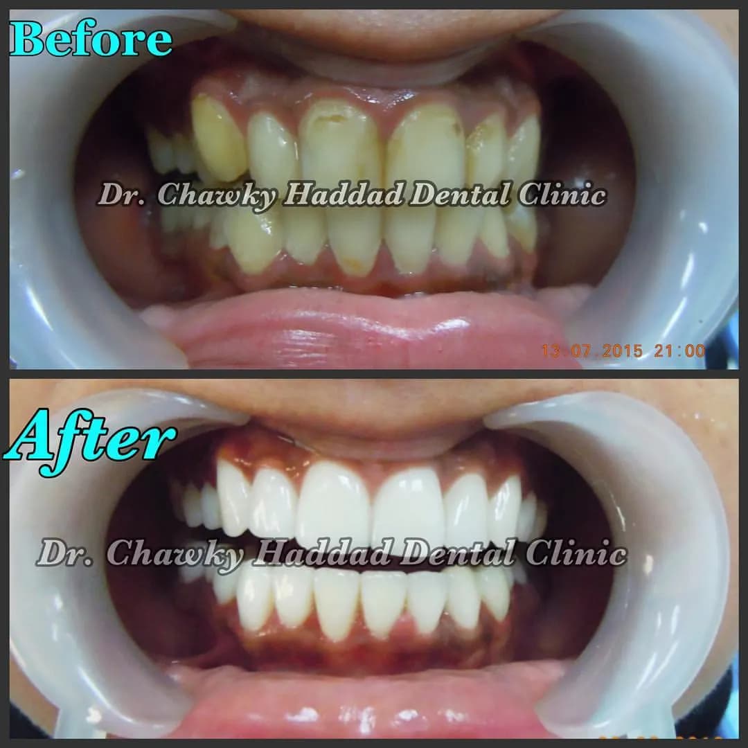 DR. Chawky Haddad Dental Clinic — صورة 7