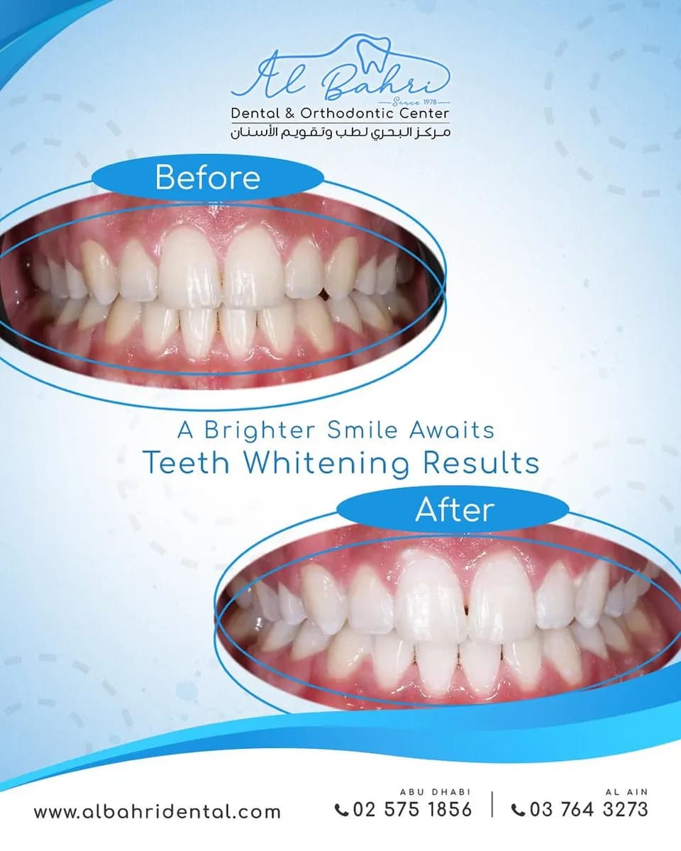 AL Bahri Dental & Orthodontics Centre photo 2