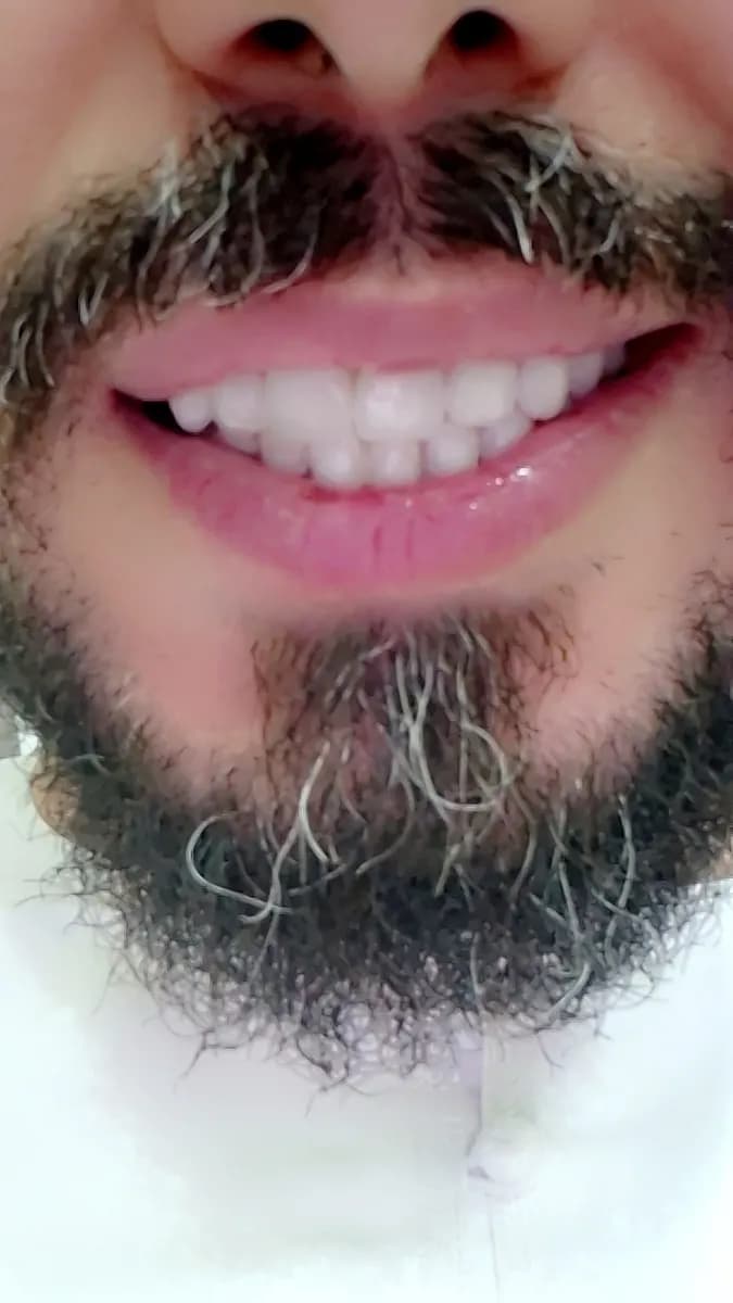 Glam Smile Dental Center photo 2