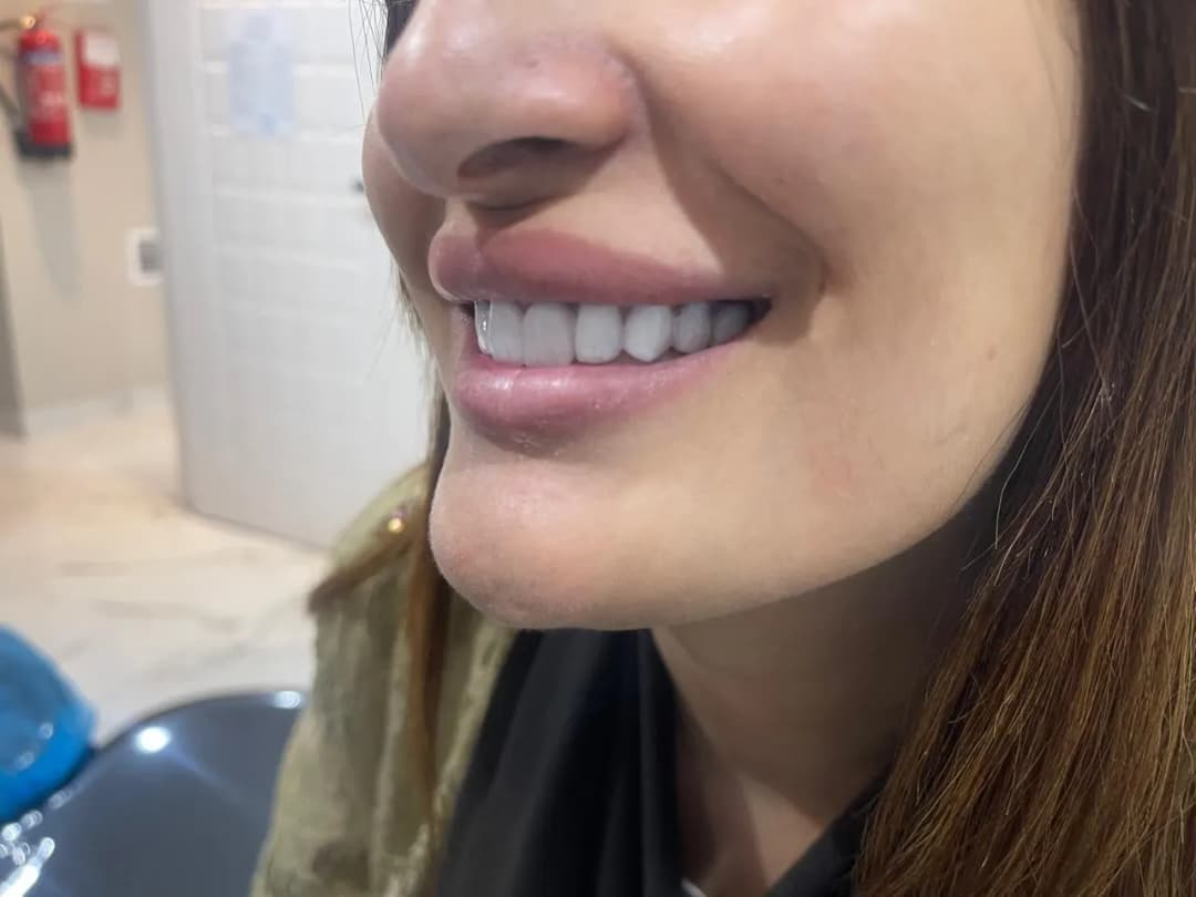 Glam Smile Dental Center photo 3