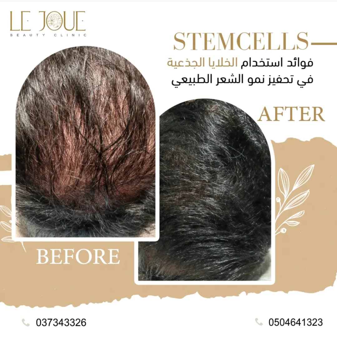 LE Joue Beauty Clinic photo 5