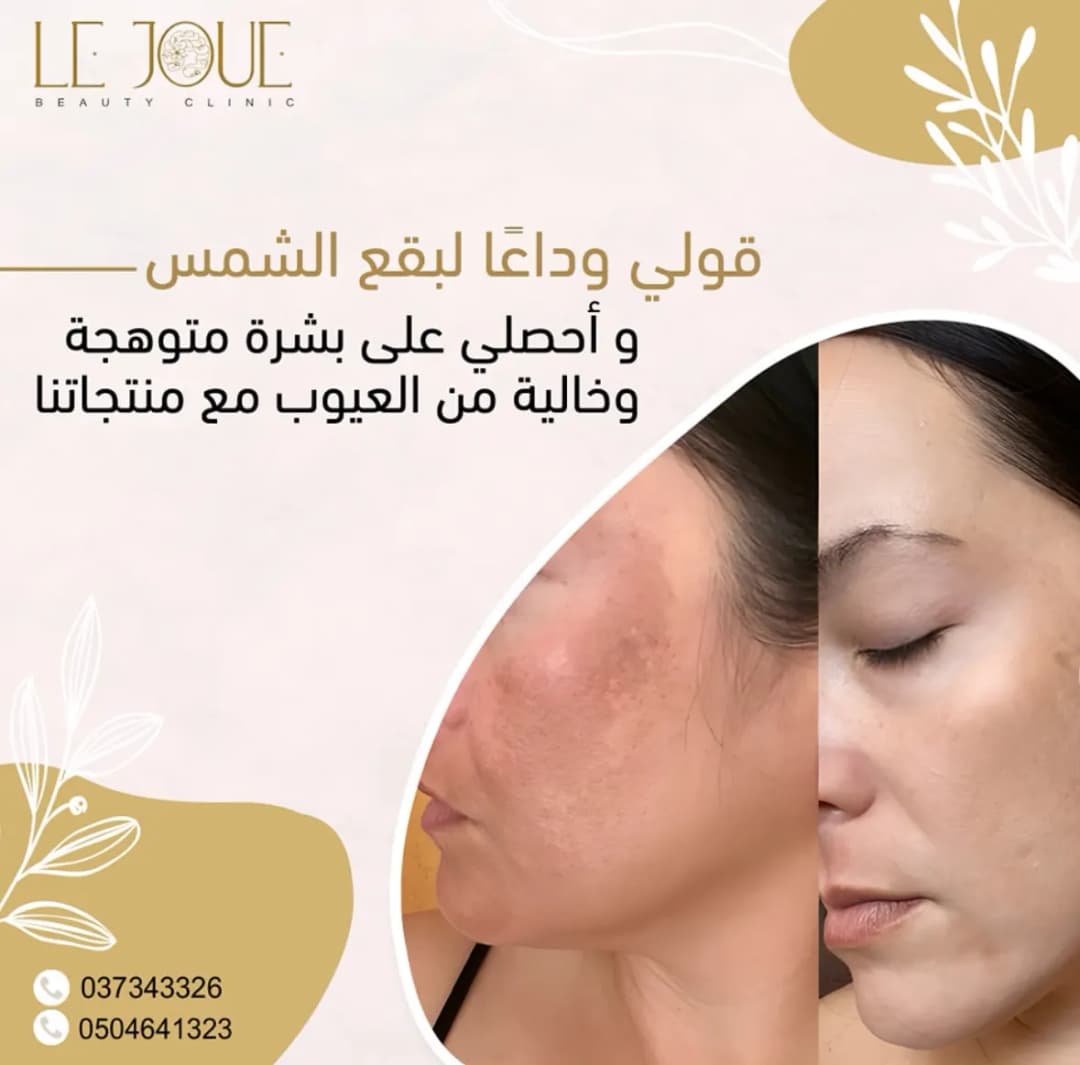 LE Joue Beauty Clinic — صورة 6