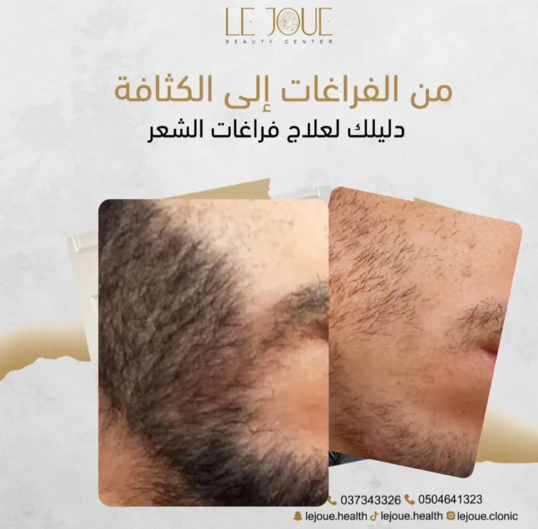 LE Joue Beauty Clinic — صورة 7