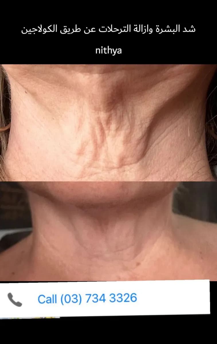 LE Joue Beauty Clinic — صورة 8