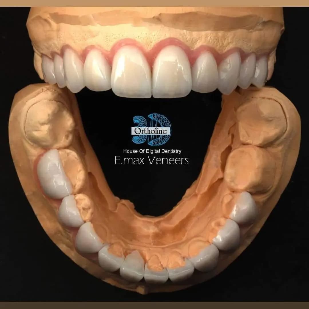 3D Ortho Line Lab photo 2