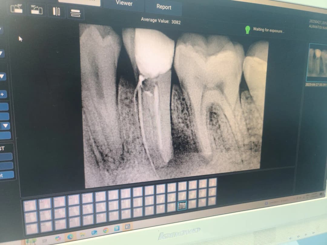 AL Furat Dental Clinic photo 5