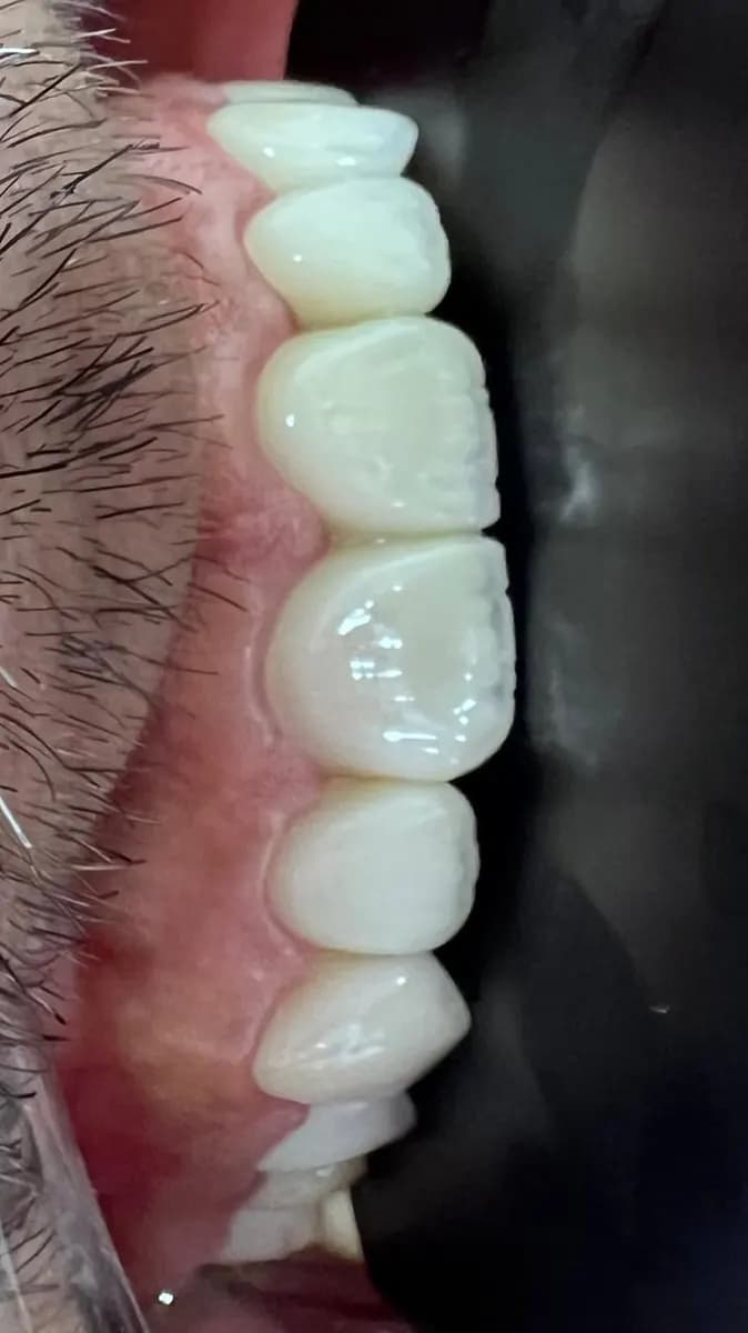 AL Haneen Dental Clinic — صورة 7