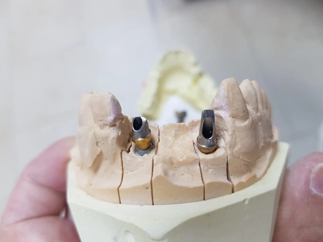 AL Wahdah Dental Laboratory photo 5