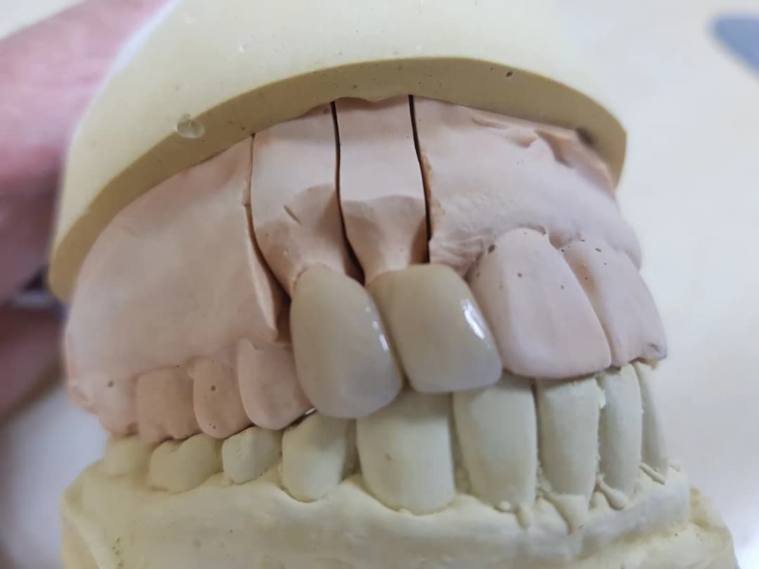 AL Wahdah Dental Laboratory — صورة 8