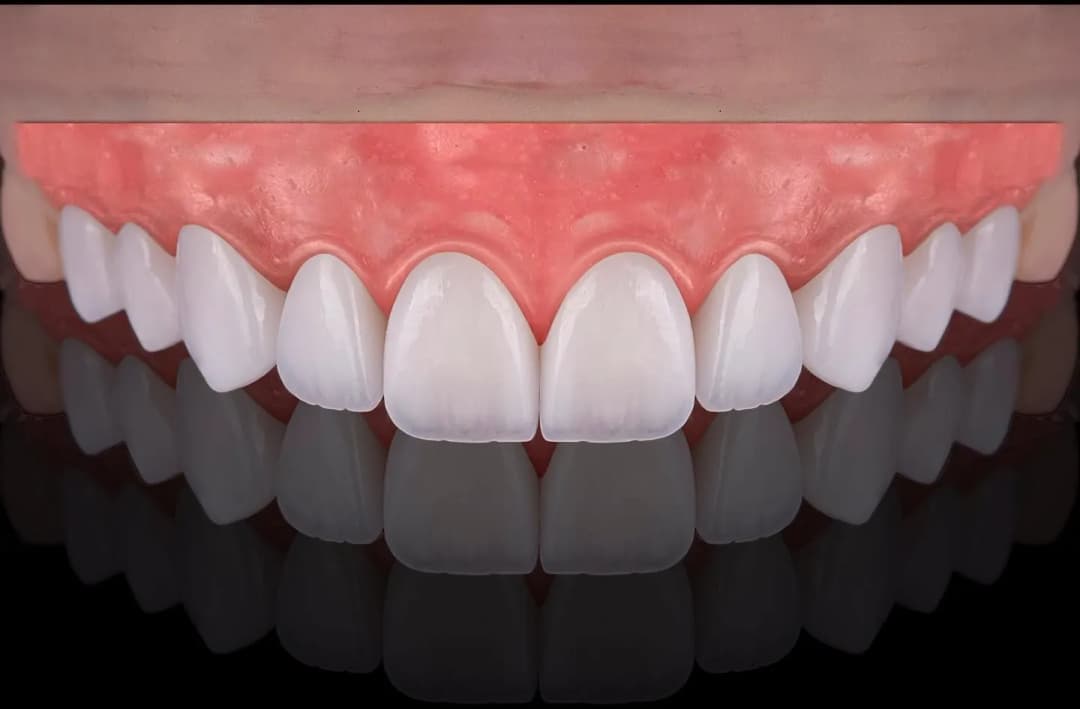 Arak Dental Lab