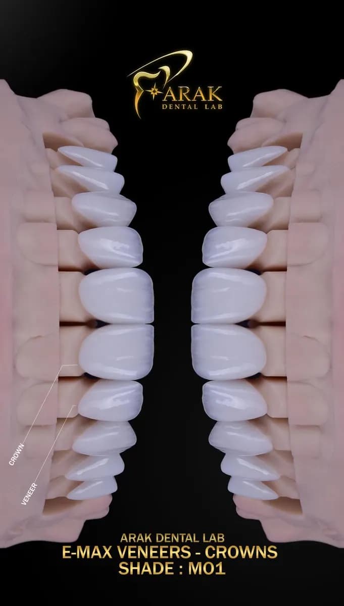 Arak Dental Lab — صورة 7