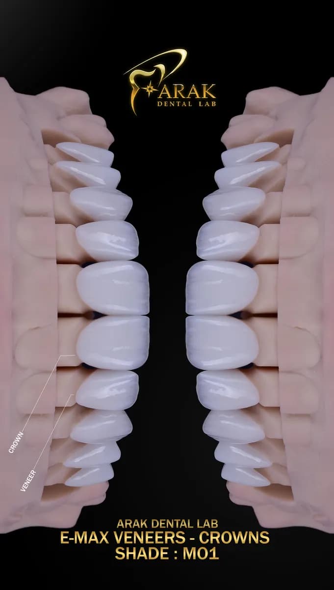 Arak Dental Lab — صورة 8