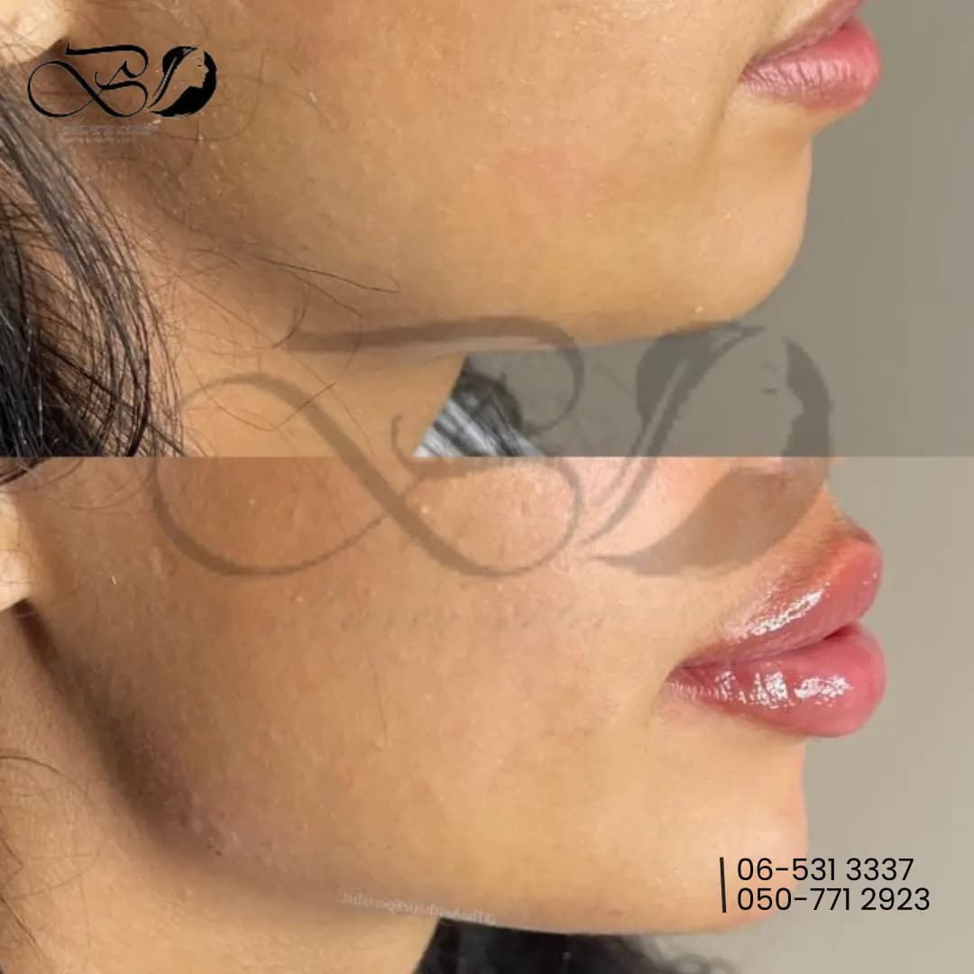 Bellavera Center Plastic Surgery photo 5