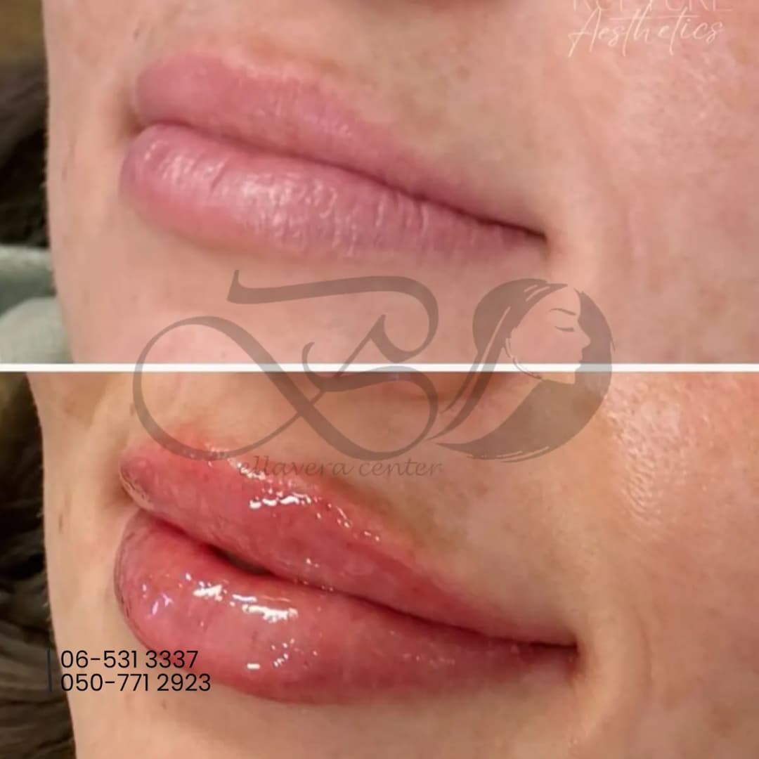 Bellavera Center Plastic Surgery — صورة 8