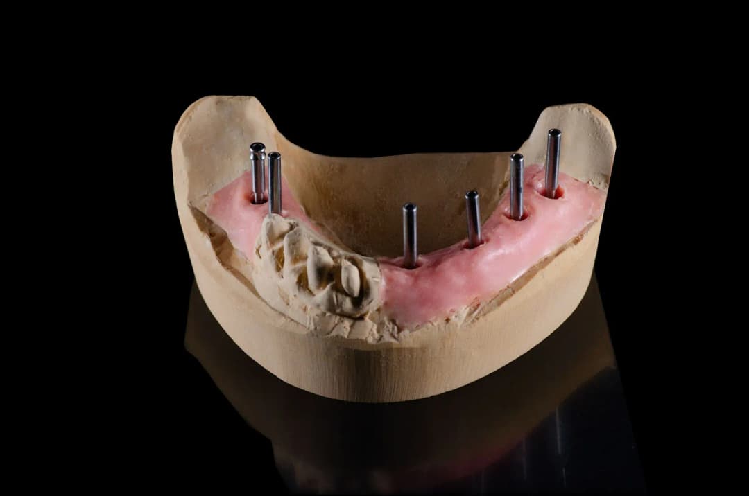 Cad-Cam Dental Lab photo 4