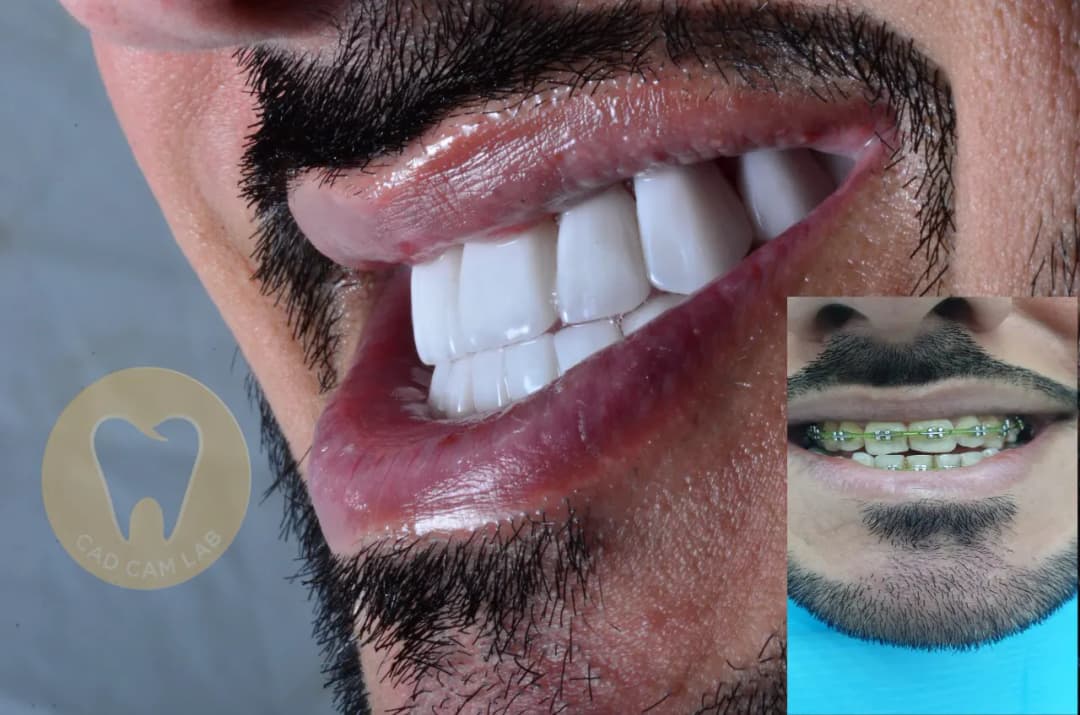 Cad-Cam Dental Lab photo 5
