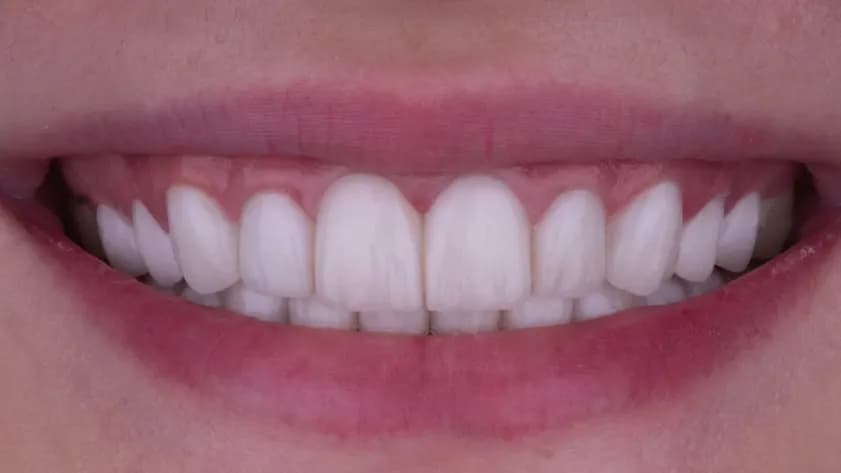 DR. Taghrid AL Taie Dental Clinic — صورة 6