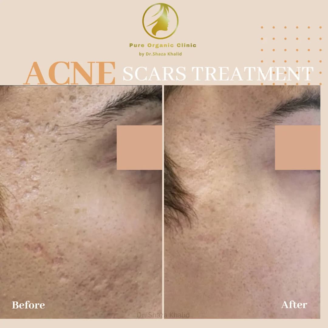 Dr.shaza Khalid Speciality Skin Clinic photo 3