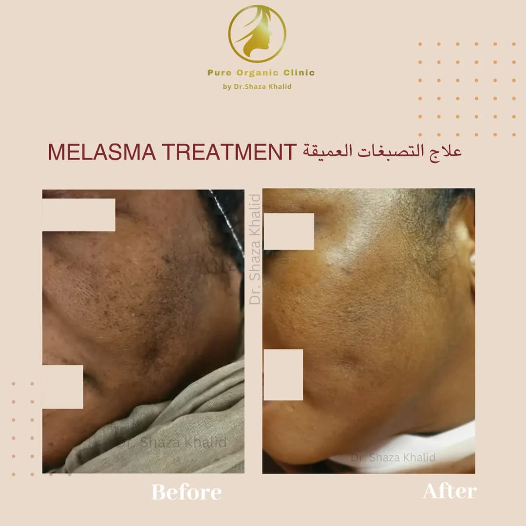 Dr.shaza Khalid Speciality Skin Clinic photo 4