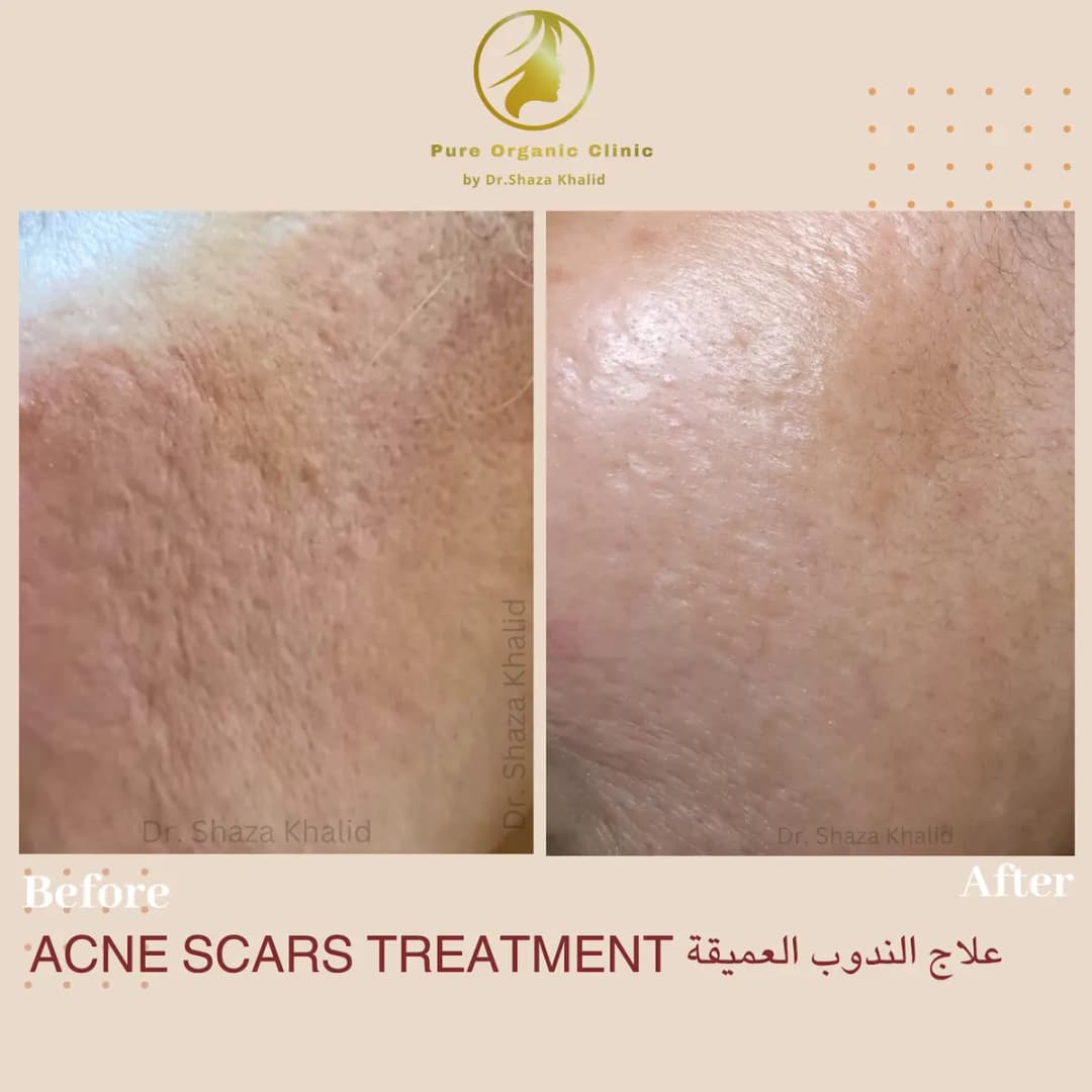Dr.shaza Khalid Speciality Skin Clinic photo 5