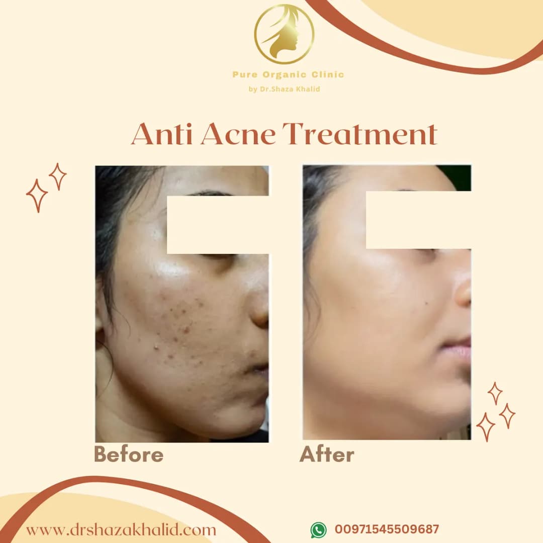 Dr.shaza Khalid Speciality Skin Clinic — صورة 6