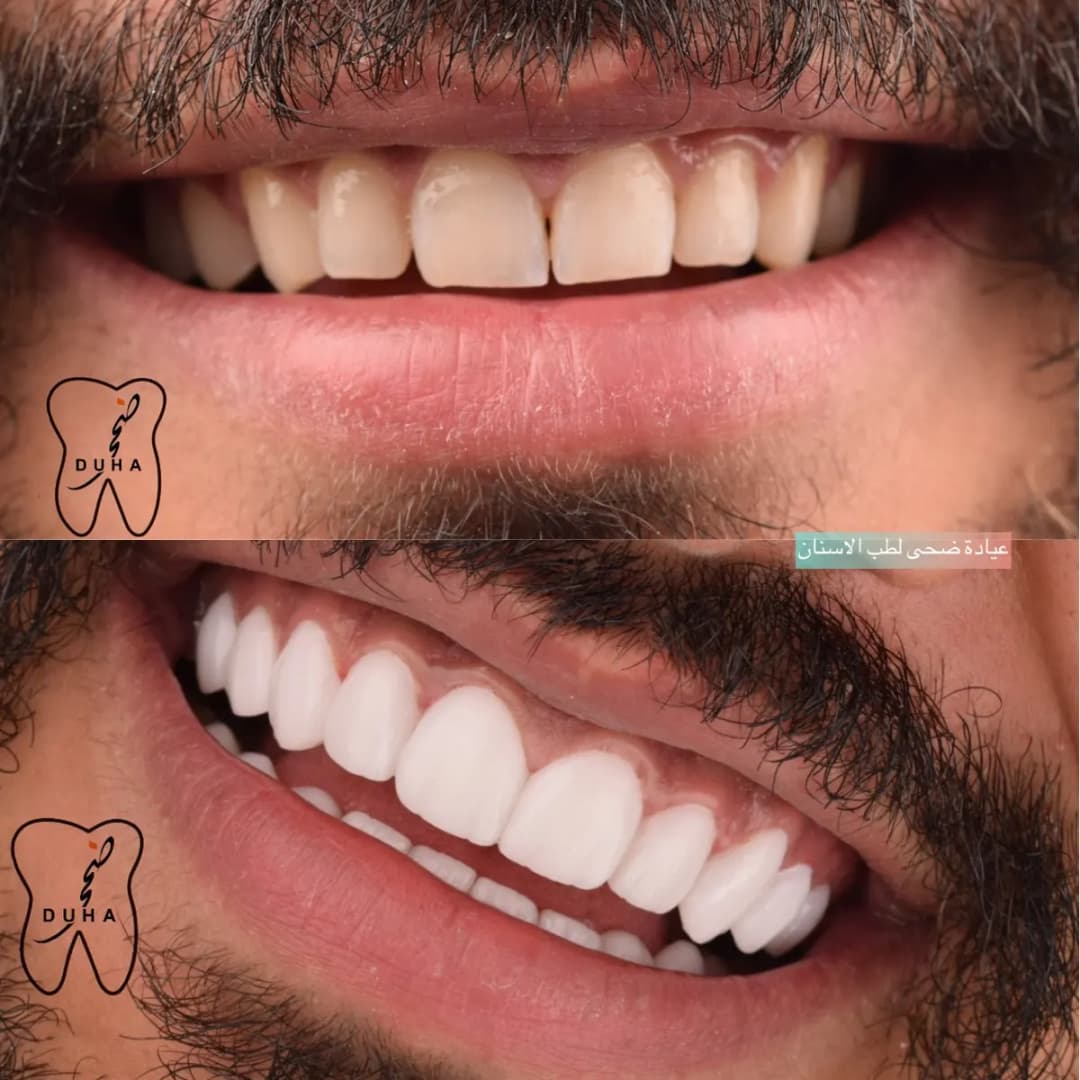 Duha Dental Clinic photo 2