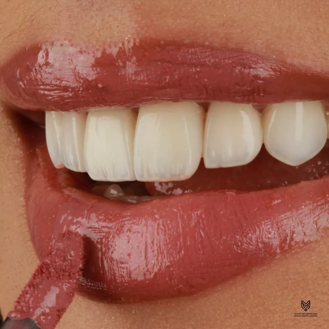 Moosa Dental Centre — صورة 2
