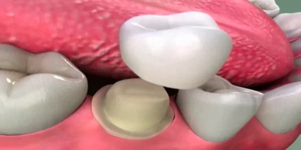 Al Duaa Dental Center — صورة 7