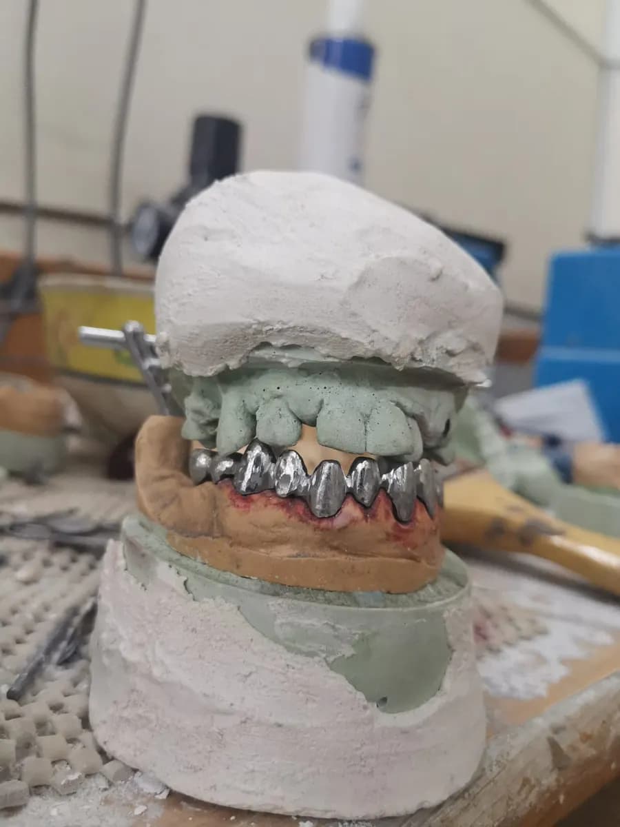 Universal Dental Lab