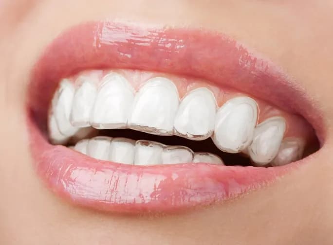 Dr. Ali Al Marzooq Dental Center — صورة 2