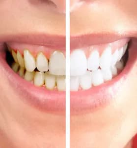 Dr. Ali Al Marzooq Dental Center — صورة 8