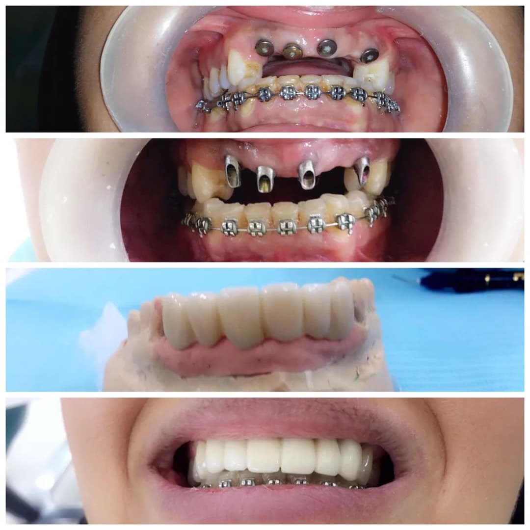 Dr.Joshi 's Al Aman Dental Center — صورة 5