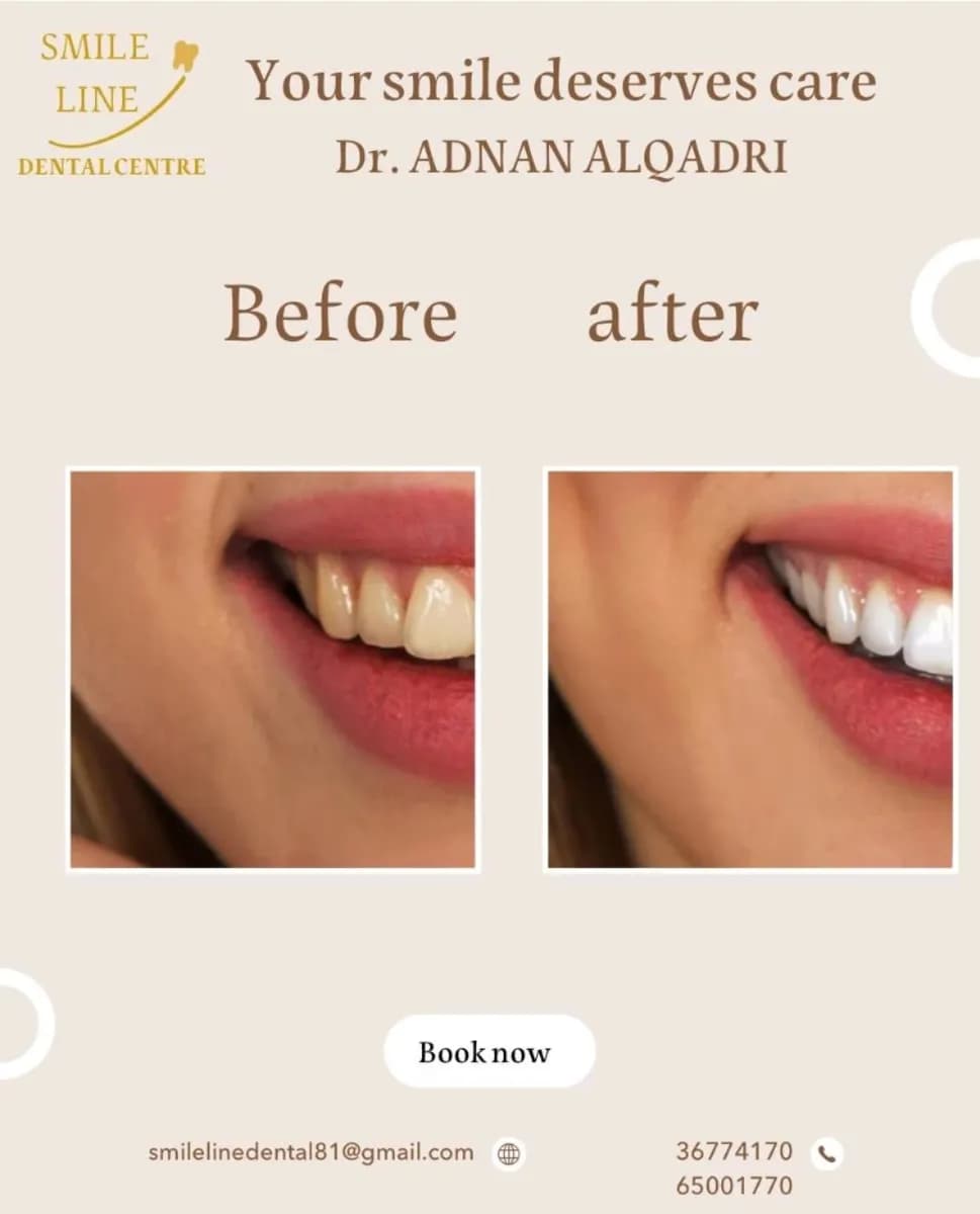 Smile Line Dental Center — صورة 4