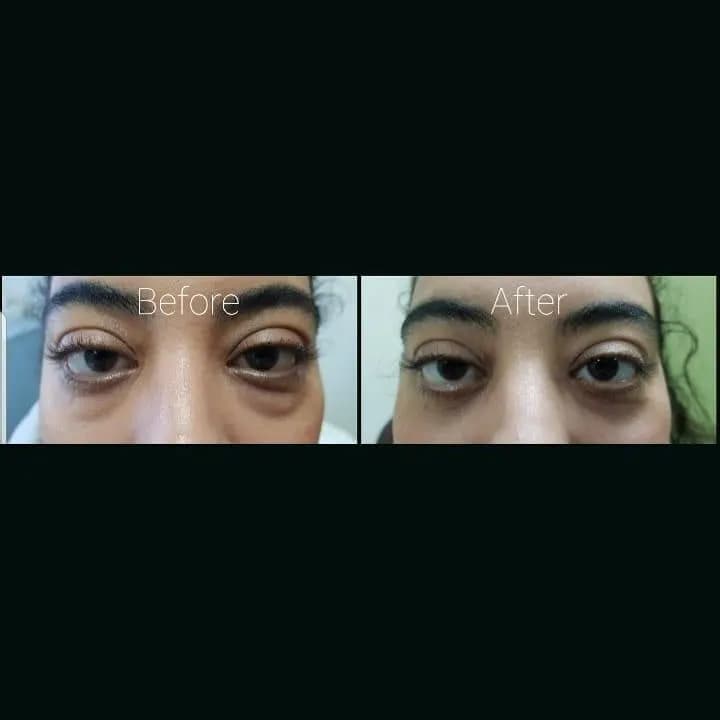 Dr. Bachar Khoury eye clinic — صورة 7