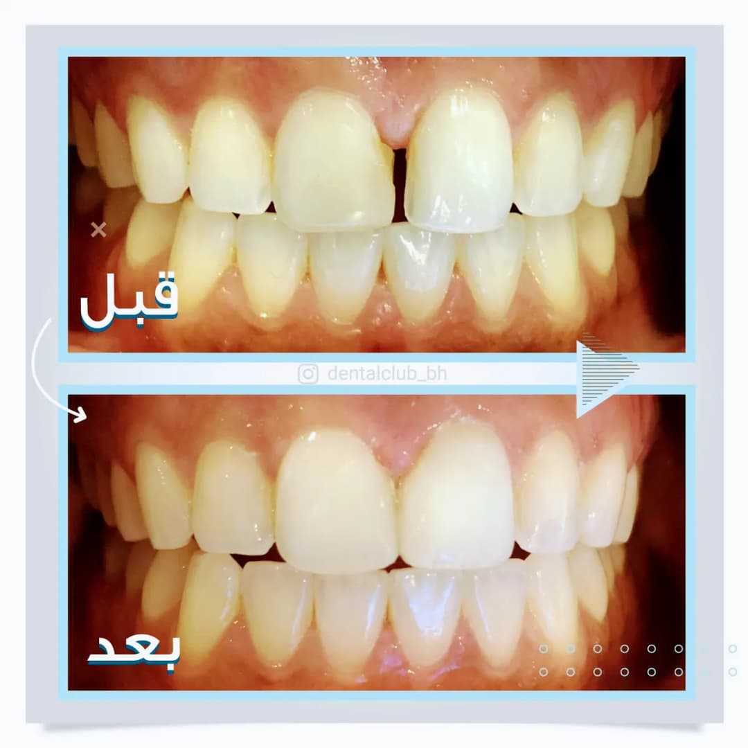 Dental Club - Dr. Ameera's Specialist Center — صورة 6