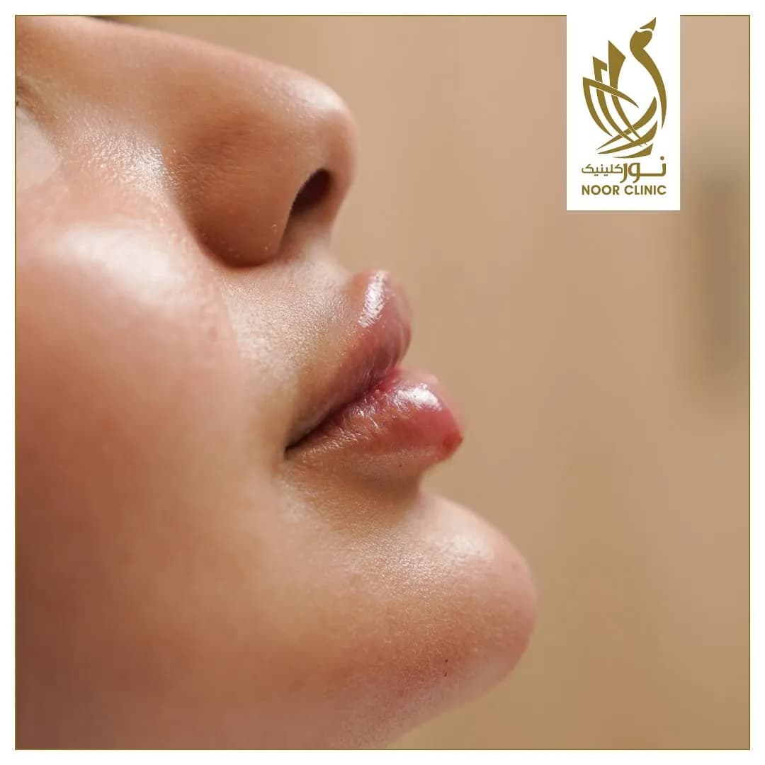 Noor Clinic (Egila) — صورة 4