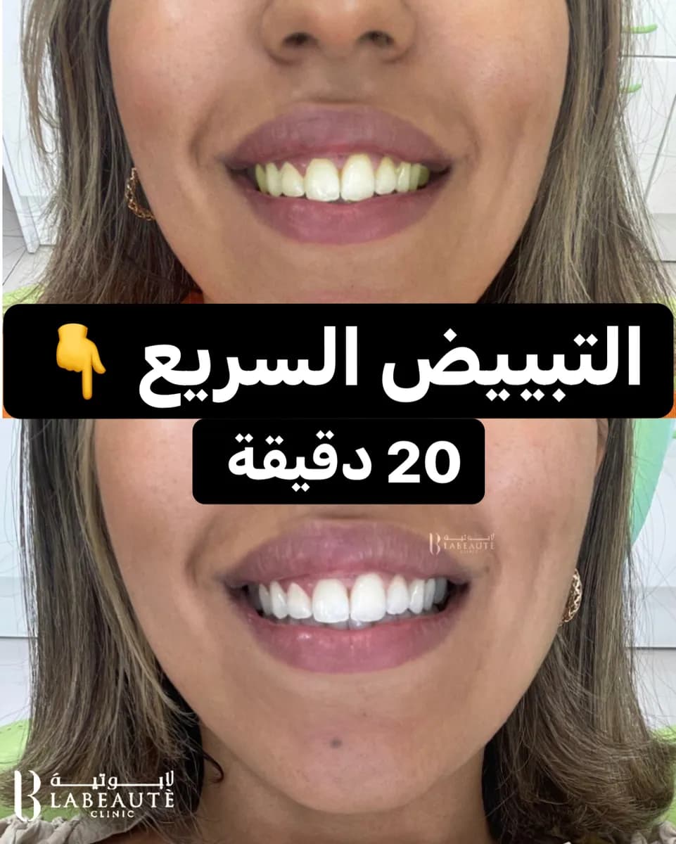 لابوتيه كلينك — صورة 8