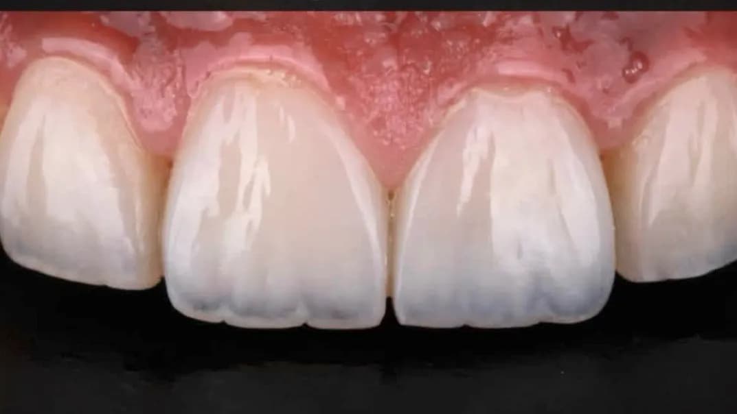 مركز أسباير لطب الأسنان | Aspire Dental Center