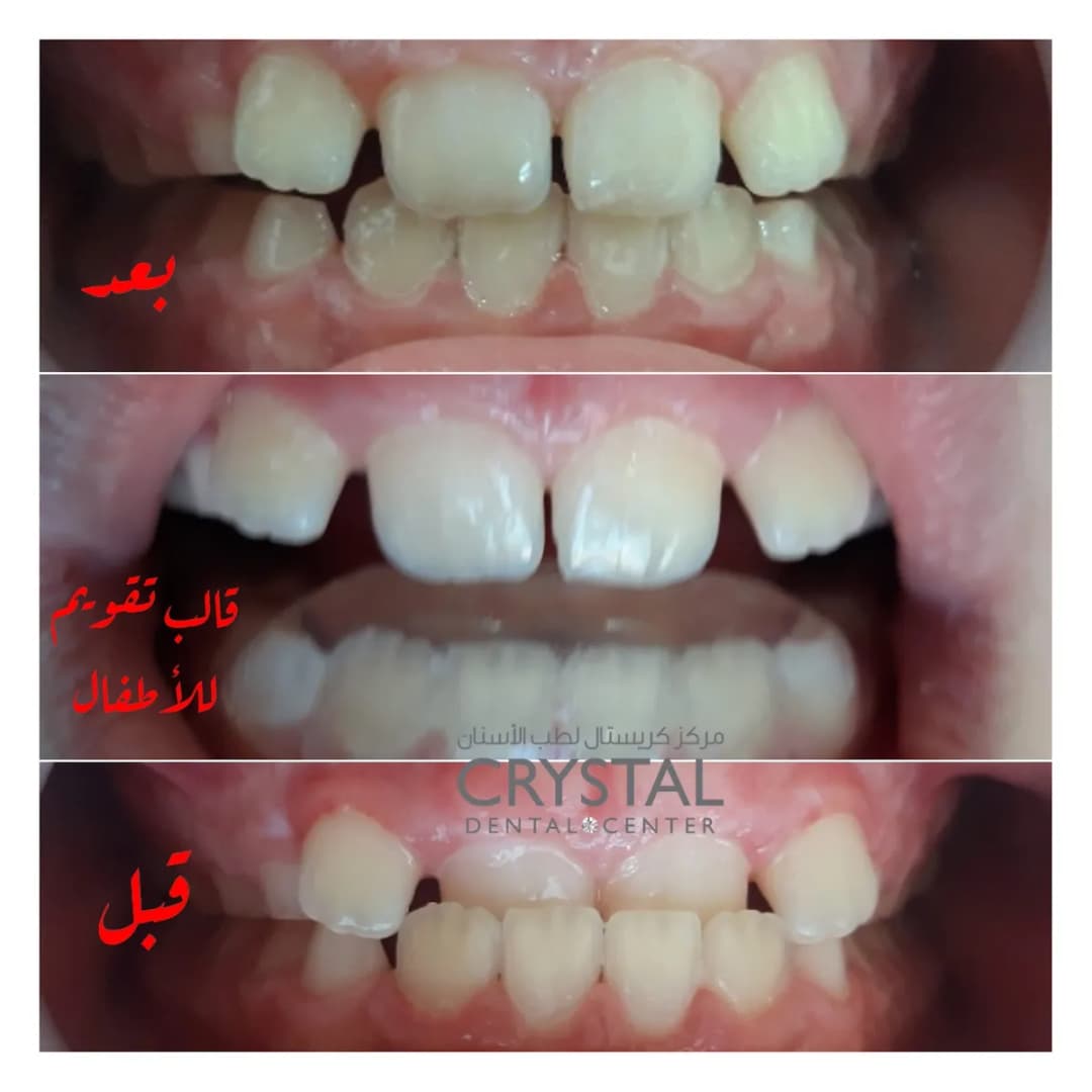 مركز كريستال لطب الأسنان — صورة 3