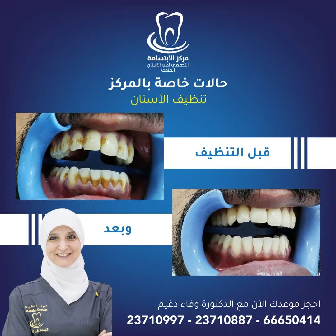 مركز الابتسامة لطب الاسنان- المنقف — صورة 6