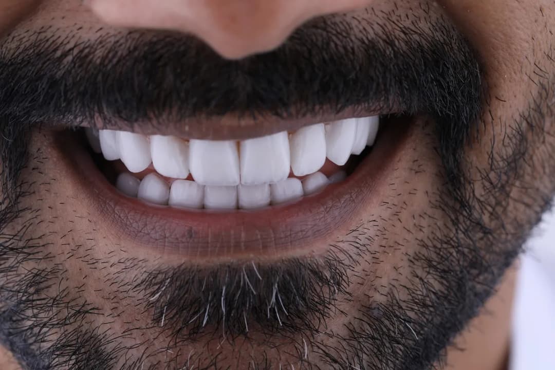 مركز شيك كلينيك لطب الأسنان — صورة 2