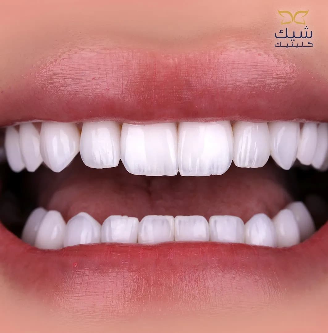 مركز شيك كلينيك لطب الأسنان — صورة 3