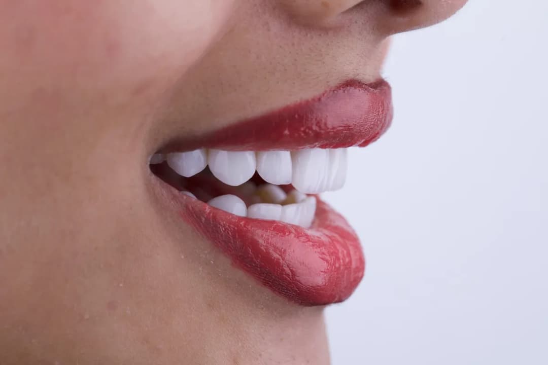 مركز شيك كلينيك لطب الأسنان — صورة 5