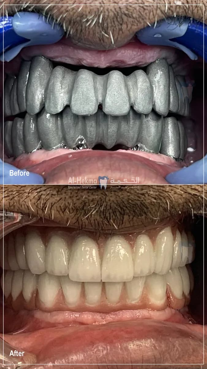 Al Hekma Dental Center - Murqab — صورة 3
