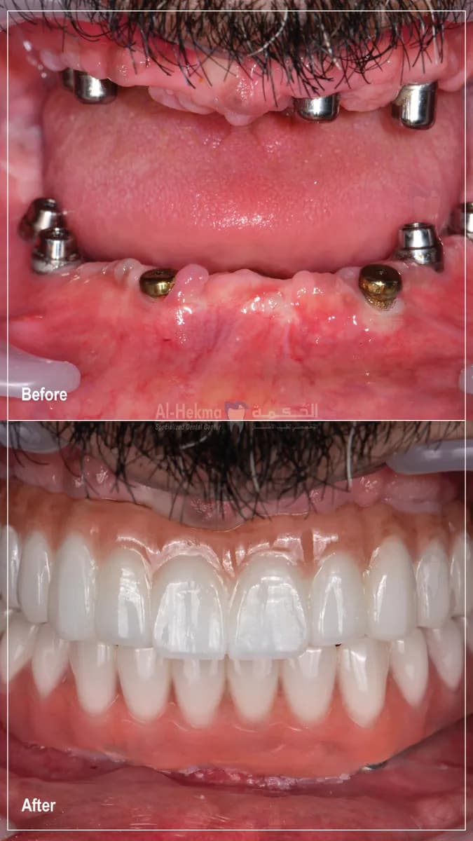 Al Hekma Dental Center - Murqab — صورة 4