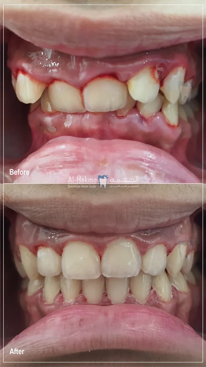 Al Hekma Dental Center - Murqab — صورة 5