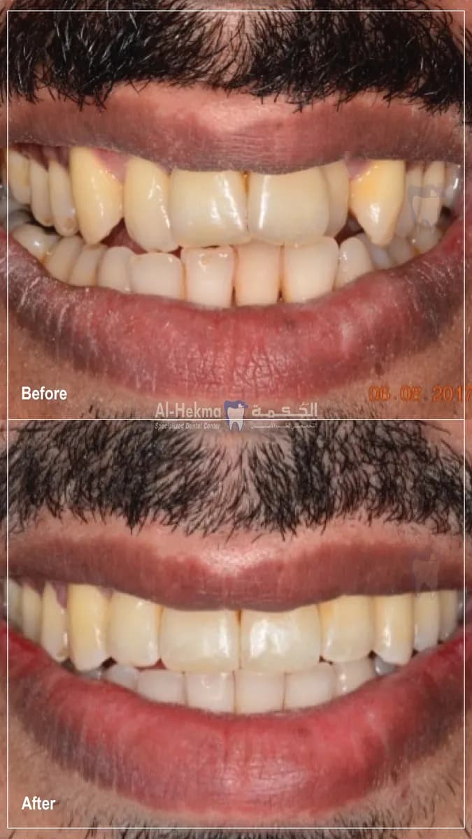 Al Hekma Dental Center - Murqab — صورة 6